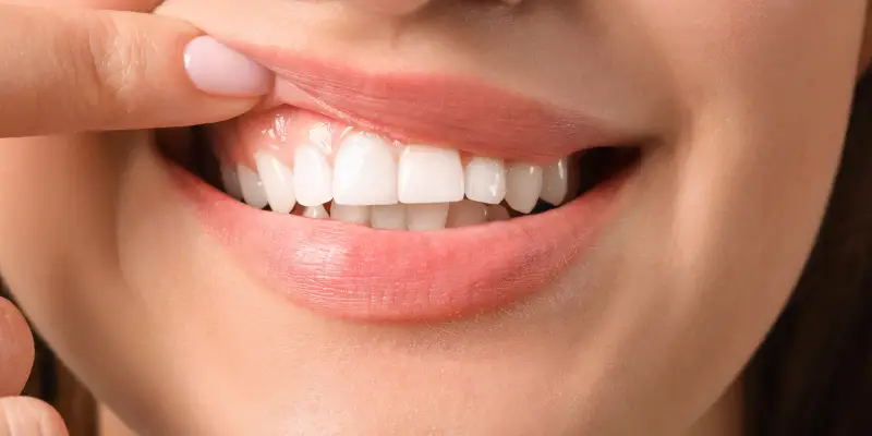 تفاوت لیفت لثه با جراحی لثه