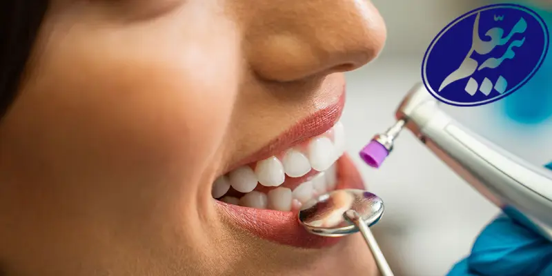 تعهدات دندانپزشکی بیمه معلم