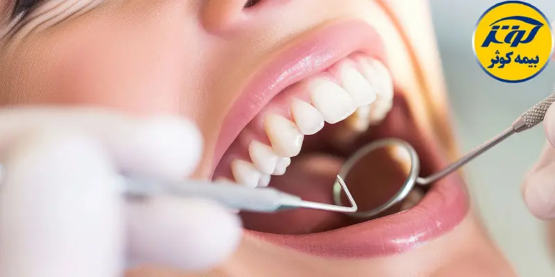 تعهدات دندانپزشکی بیمه کوثر